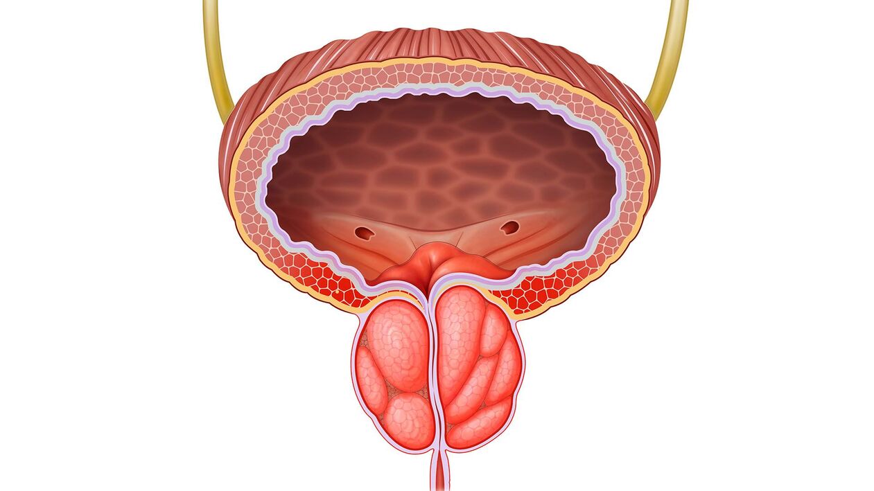 prostata infiammata